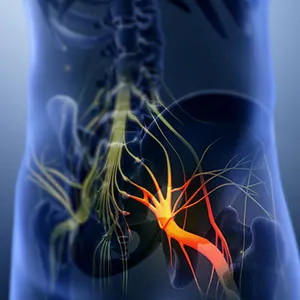 Back Pain with Sciatica during Lockdown Photo